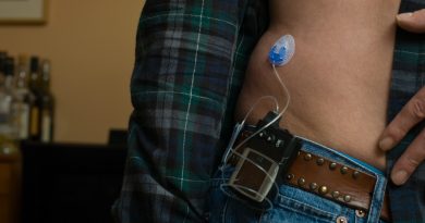 FDA aprueba páncreas artificial de Medtronic para tratar la diabetes FDA aprueba páncreas artificial de Medtronic para tratar la diabetes