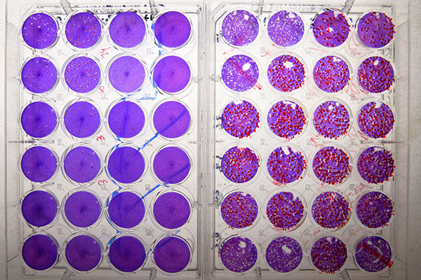 En la placa de la izquierda, el virus es sensible a la acción del antiviral, no genera daño en la capa celular ya que bloquea la replicacion viral. En la placa de la derecha: el virus es resistente a la acción del antiviral generando huecos en la capa de celulas como consecuencia de la replicación viral. Foto: Diana Martinez Llaser.